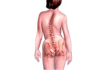 Důvody rozvoje cervikální osteochondózy
