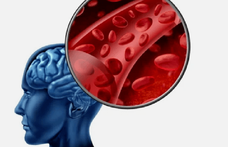 Příznaky osteochondrosy krční páteře