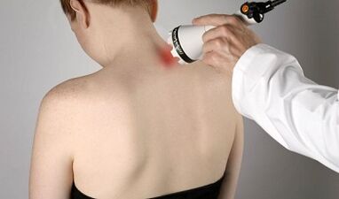 Léčba bolesti ve fyzioterapeutických postupech krku