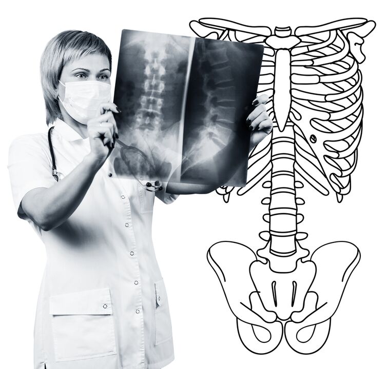 Radiografie bederní páteře